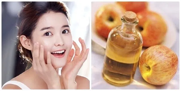 Sử dụng mặt nạ giấm táo và mặt ong 2 lần/tuần (Ảnh: Internet)