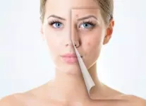 Thực hư tác dụng giảm nhăn của kem mắt - khi công dụng bị tâng bốc quá đà 2
