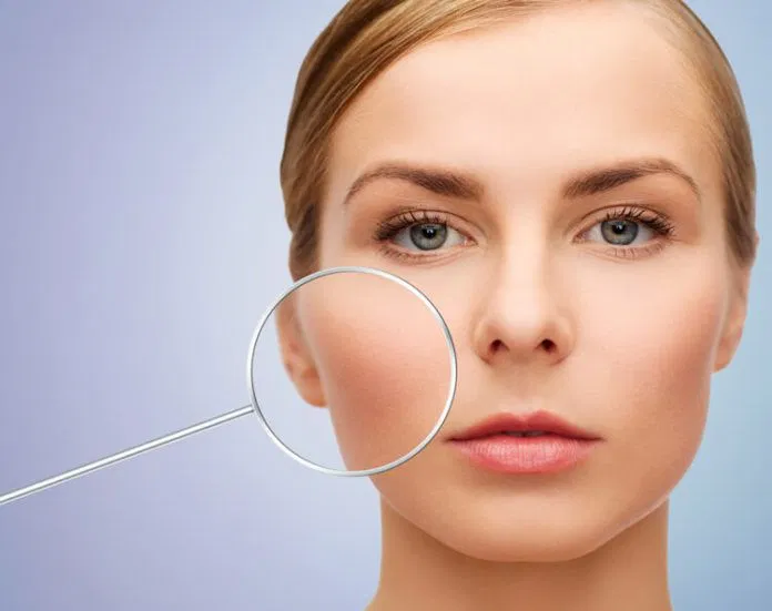 Làm gì để thu nhỏ lỗ chân lông