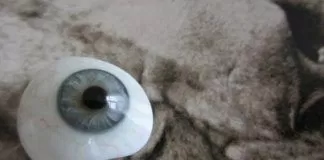 mắt giả