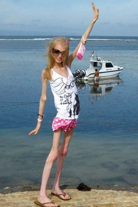 Nguoi phu nu gay nhat hanh tinh