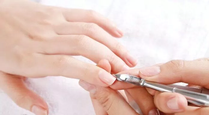 Cắt tỉa móng