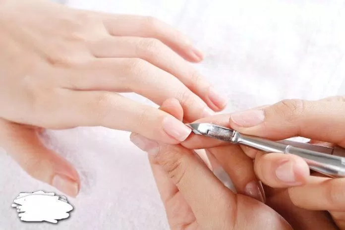 Cắt tỉa móng