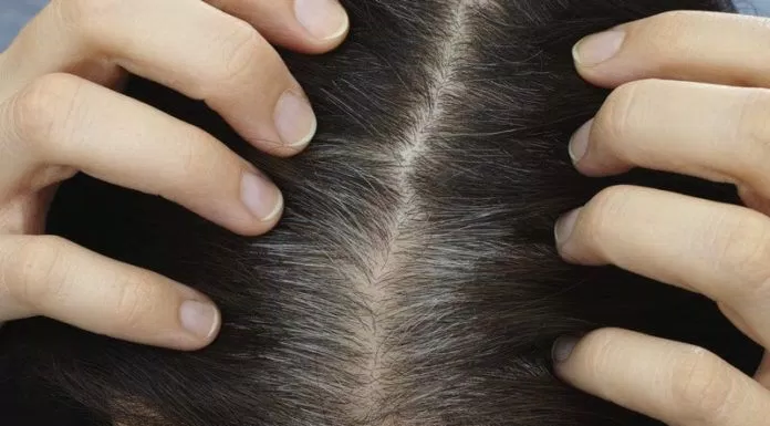Tóc bạc