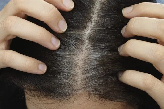 Tóc bạc