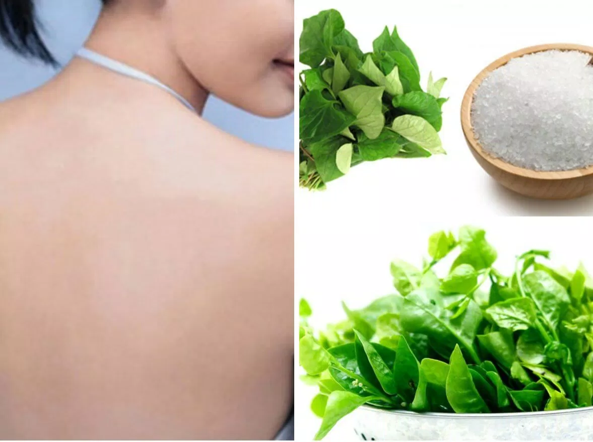 Trị mụn nhọt