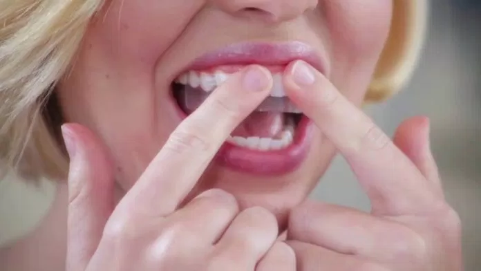 Cách dán miếng trắng răng Crest