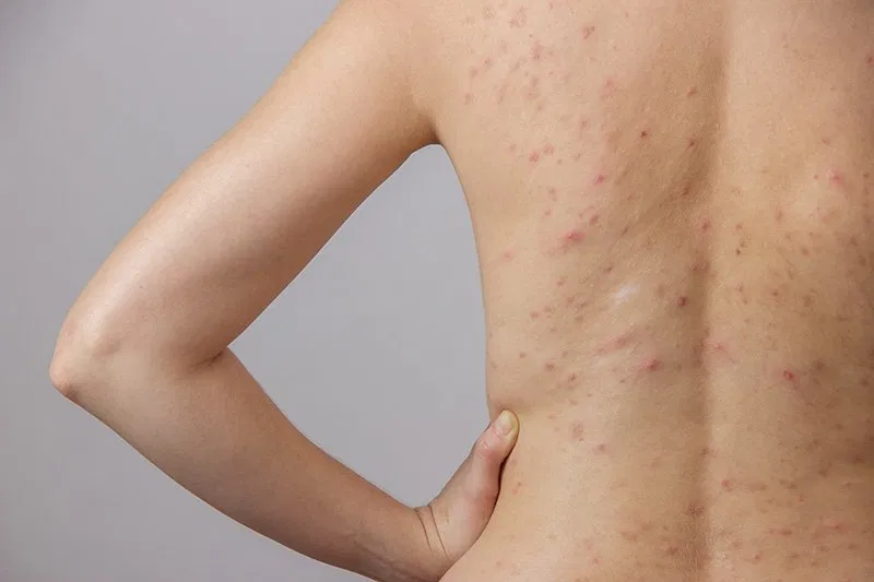 Tắm nước lá ổi
