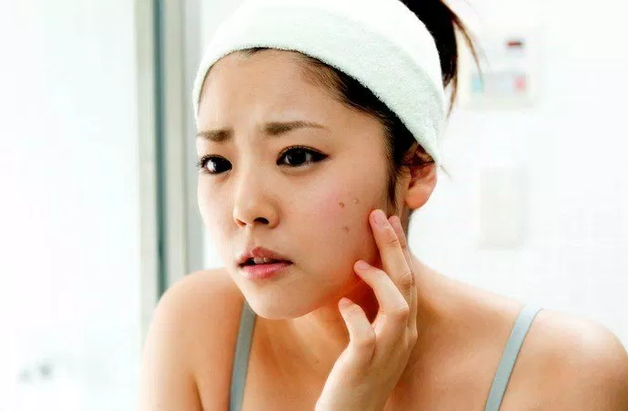 7 cách giảm mụn sưng tấy tại nhà cho làn da mịn màng