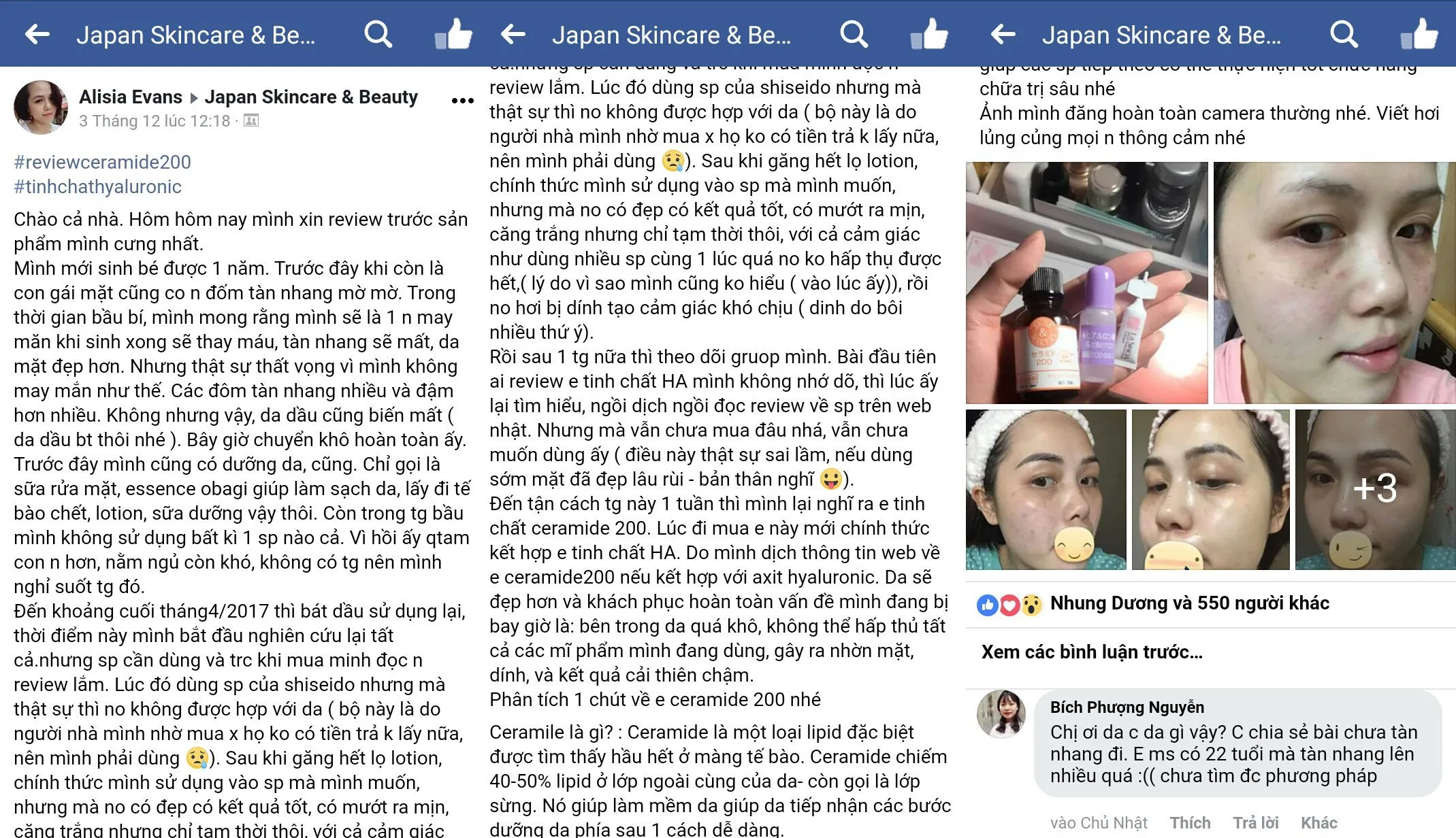 Review serum Hyaluronic Acid nguyên chất Taiyou No Aloe Nhật Bản