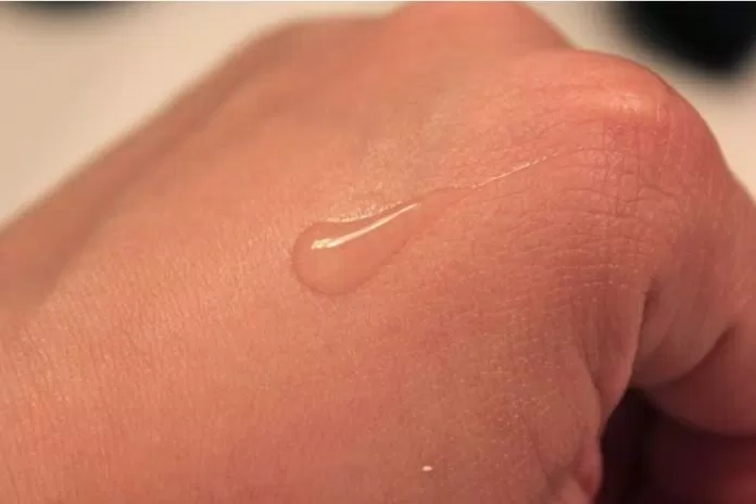 Review serum trị thâm, làm trắng Murad Rapid Age Spot and Pigment Lightening