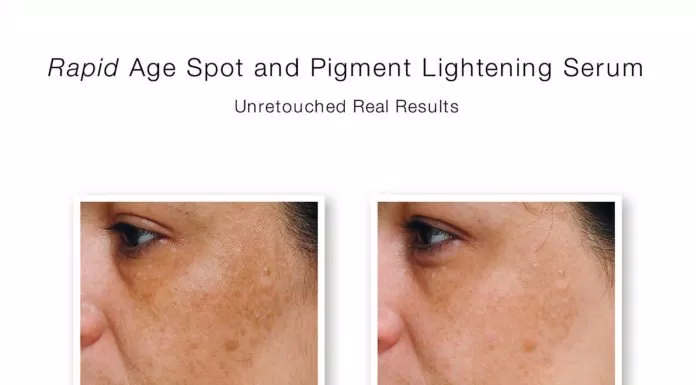 Review serum trị thâm, làm trắng Murad Rapid Age Spot and Pigment Lightening