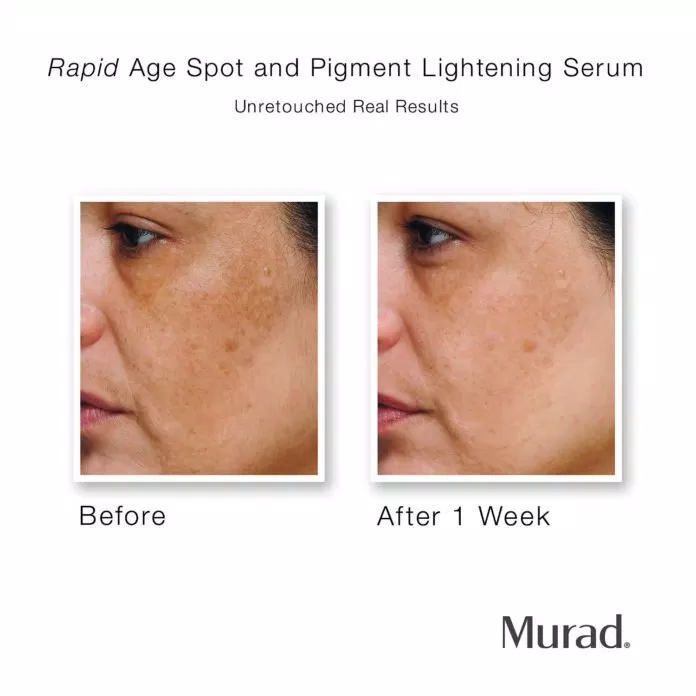 Review serum trị thâm, làm trắng Murad Rapid Age Spot and Pigment Lightening