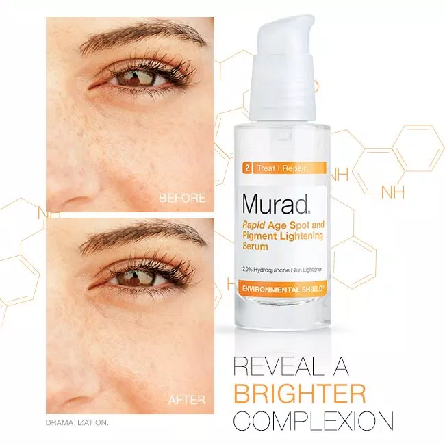 Review serum trị thâm, làm trắng Murad Rapid Age Spot and Pigment Lightening