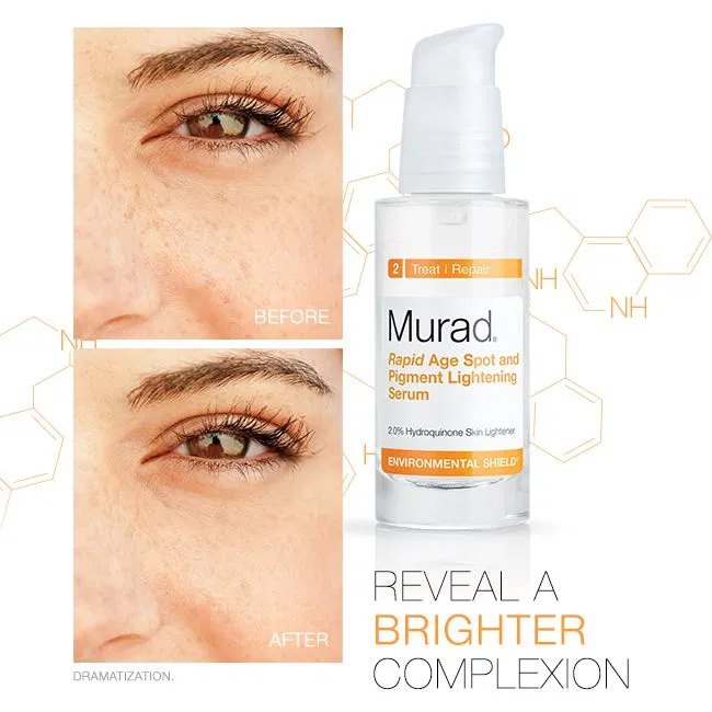 Review serum trị thâm, làm trắng Murad Rapid Age Spot and Pigment Lightening