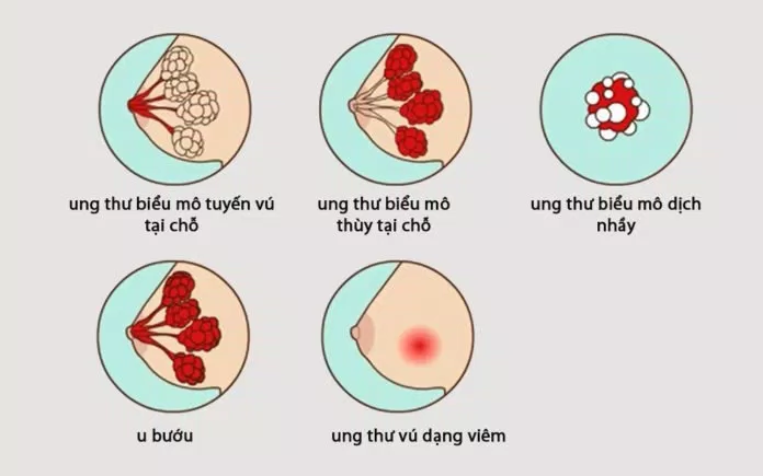 tác hại của thức khuya