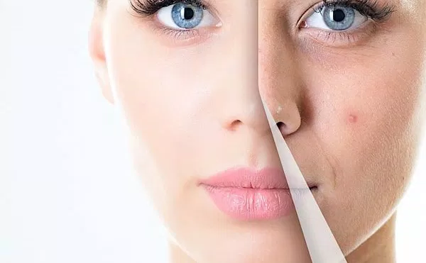 chăm sóc da tuổi 40