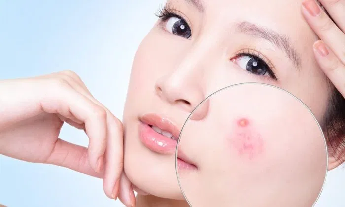 tác hại của điện thoại đối với da