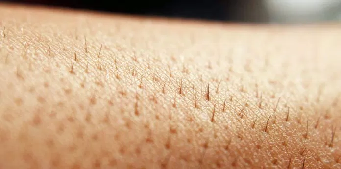 triệt lông vĩnh viễn
