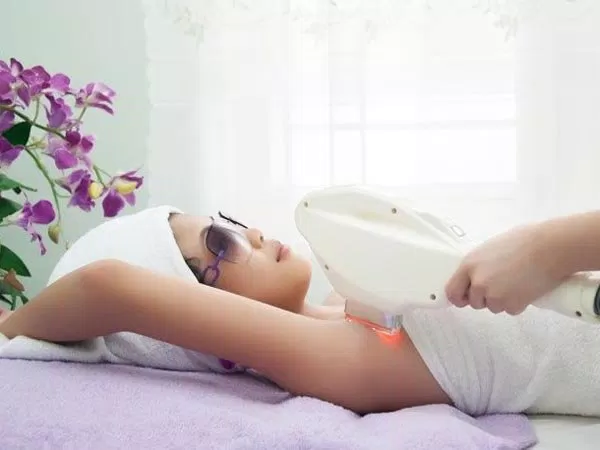 triệt lông vĩnh viễn