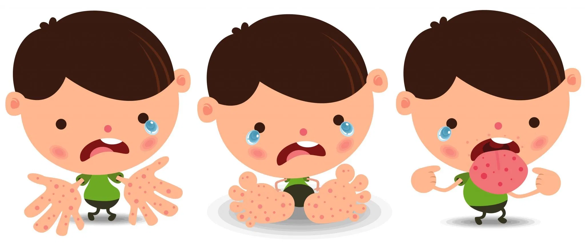 Bệnh mùa nóng ở trẻ em