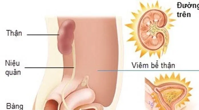 tiết niệu