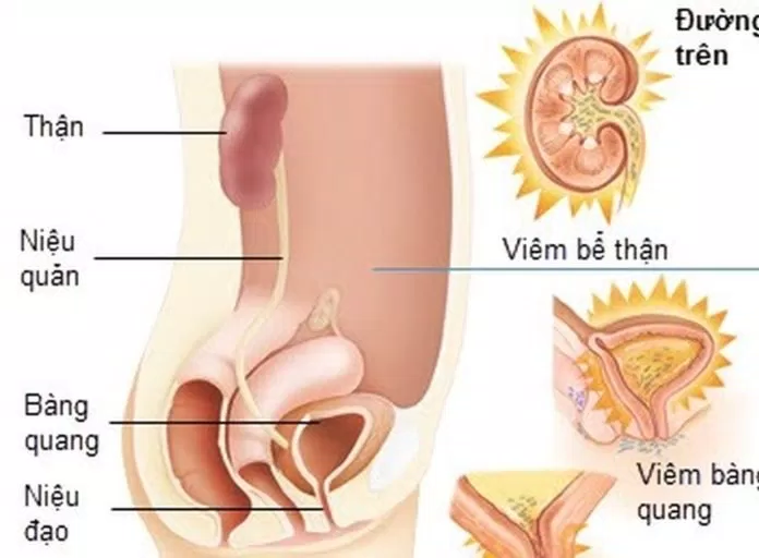 tiết niệu