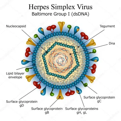herpes