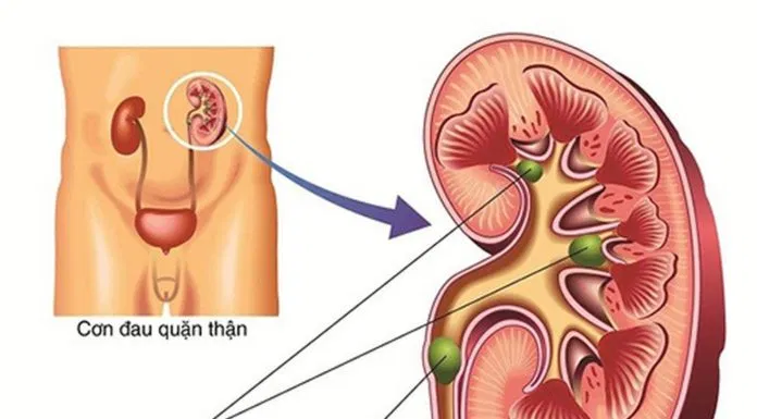 uống nước đúng cách