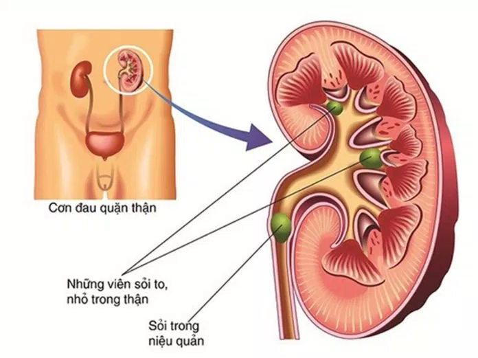 uống nước đúng cách