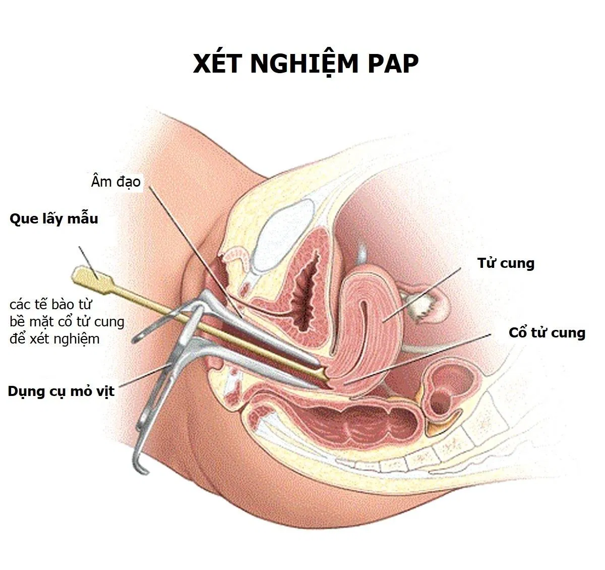 Xét nghiệm PAP