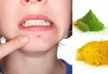 cover trị mụn cằm