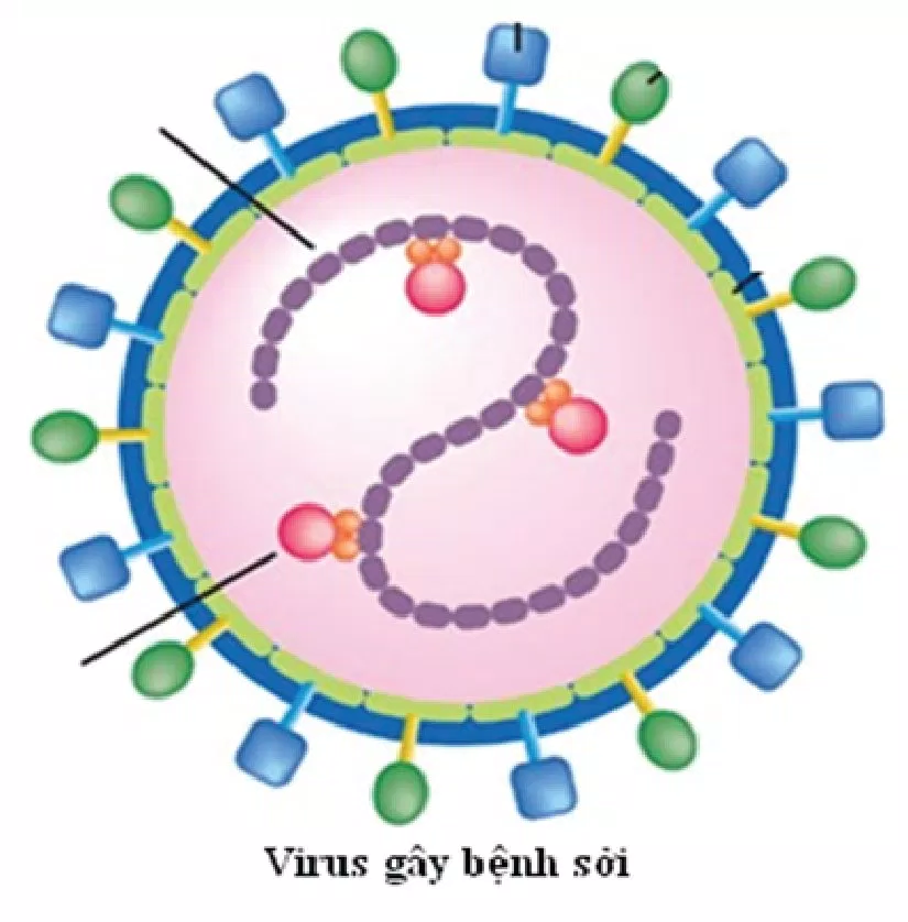 Triệu chứng bệnh sởi