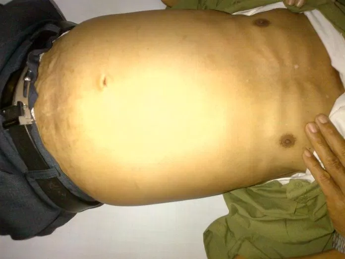 cổ trướng