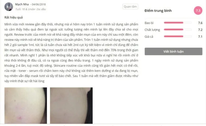 Đánh giá khách hàng sử dụng sản phẩm Bija Cica Balm. (Nguồn: BlogAnChoi)