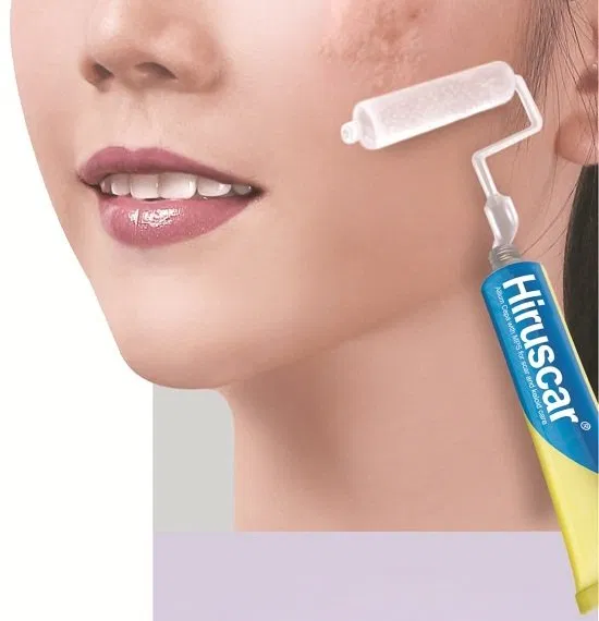 Kem trị sẹo Hiruscar (Nguồn: Internet) Kem trị sẹo Hiruscar (Nguồn: Internet)