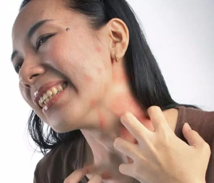 Nếu bạn bị dị ứng với quả óc chó, hãy ngừng ngay việc tiêu thụ loại quả này để đảm bảo an toàn cho sức khỏe của chính mình. Nếu bạn bị dị ứng với quả óc chó, hãy ngừng ngay việc tiêu thụ loại quả này để đảm bảo an toàn cho sức khỏe của chính mình.