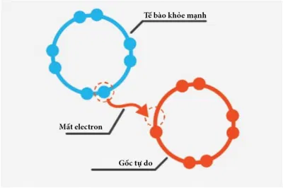 Gốc tự do lấy các điện tử để thành lập chuỗi tự do, là nguyên nhân hàng đầu gây ung thư Gốc tự do lấy các điện tử để thành lập chuỗi tự do, là nguyên nhân hàng đầu gây ung thư