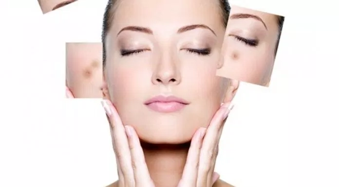 Kem nghệ trị mụn, thâm tốt - Nacurgo gel Kem nghệ trị mụn, thâm tốt - Nacurgo gel