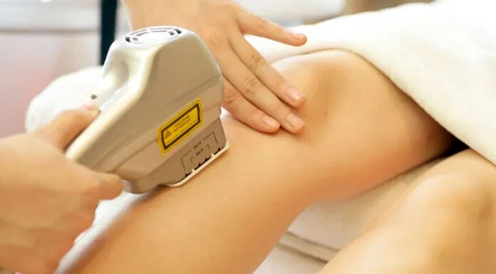 Triệt lông laser có thể dùng với mọi vùng da trên cơ thể (Nguồn: Internet)