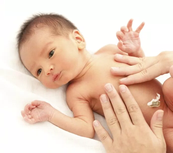 chăm sóc rốn trẻ sơ sinh