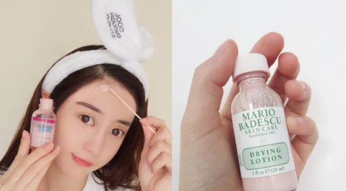 Sử dụng sản phẩm trị mụn Mario Badescu Drying Lotion xẹp đốm mụn sau 1 đêm