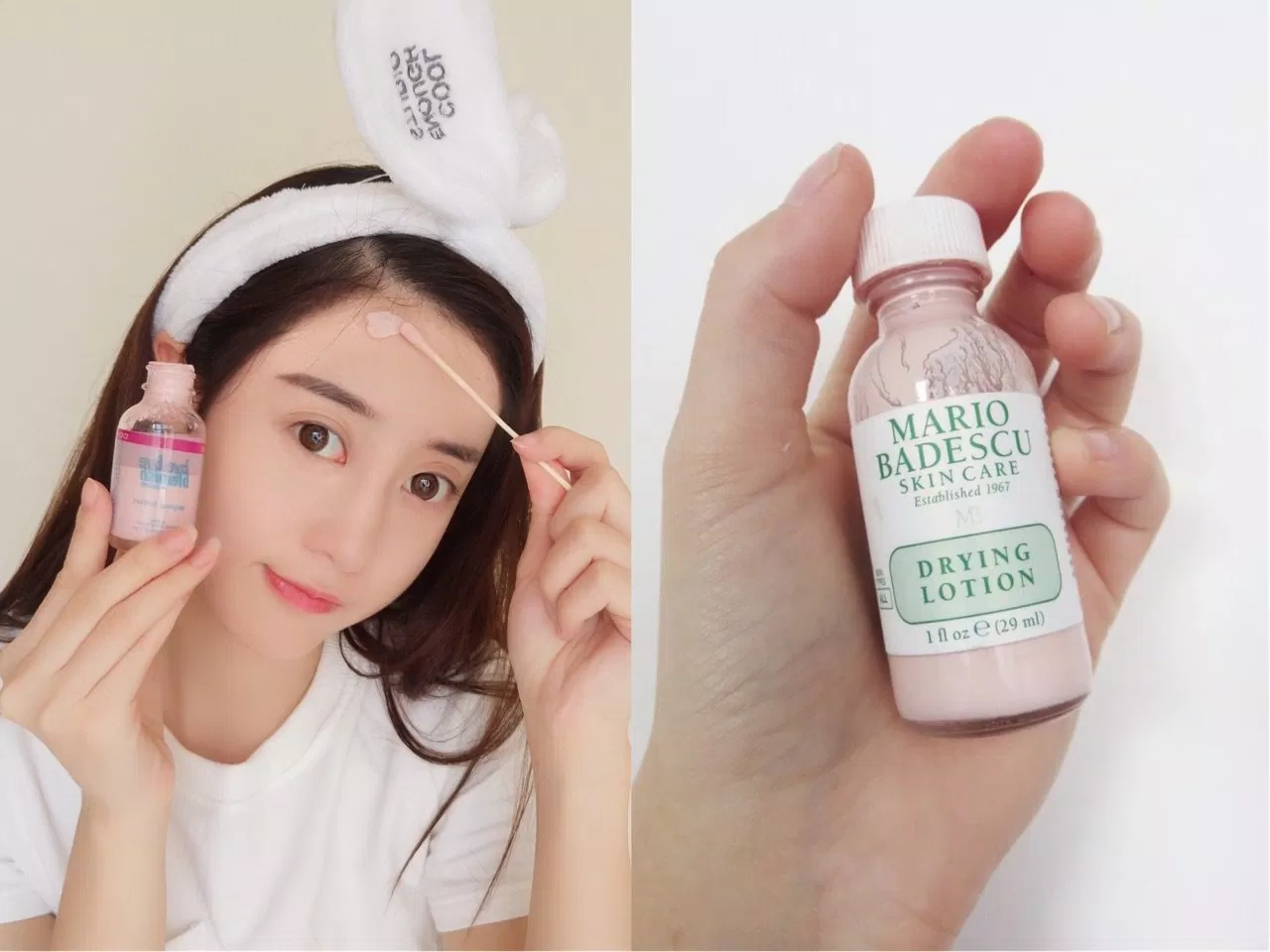 Sử dụng sản phẩm trị mụn Mario Badescu Drying Lotion xẹp đốm mụn sau 1 đêm