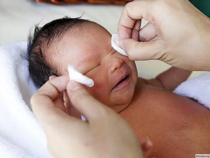 vệ sinh mắt bé
