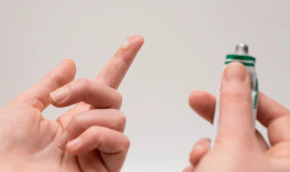 Salicylic acid - "kẻ thù" của mụn trứng cá (ảnh internet)