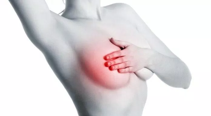 Ung thư vú: nguyên nhân, triệu chứng và cách điều trị