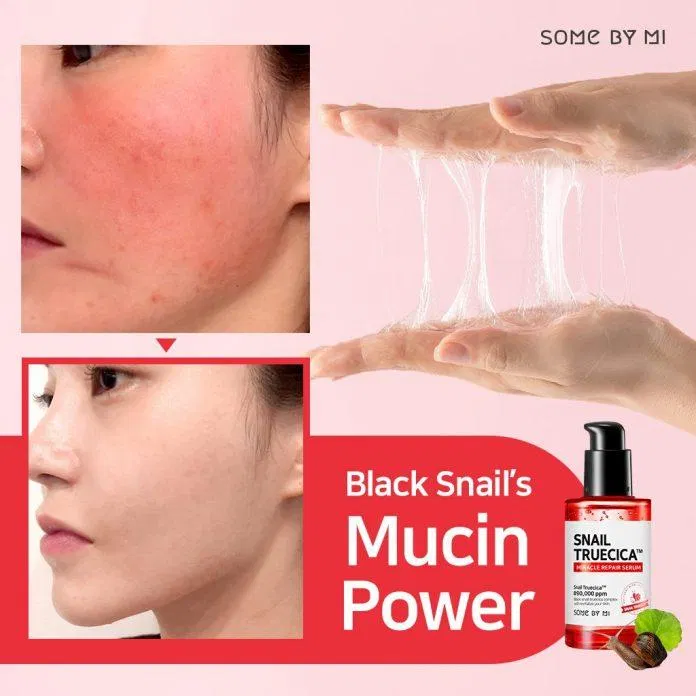 Snail Truecica Miracle Repair Serum được hãng quảng cáo là có khả năng cải thiện tình trạng sẹo lõm sau mụn. (Nguồn: Internet) Snail Truecica Miracle Repair Serum được hãng quảng cáo là có khả năng cải thiện tình trạng sẹo lõm sau mụn. (Nguồn: Internet)
