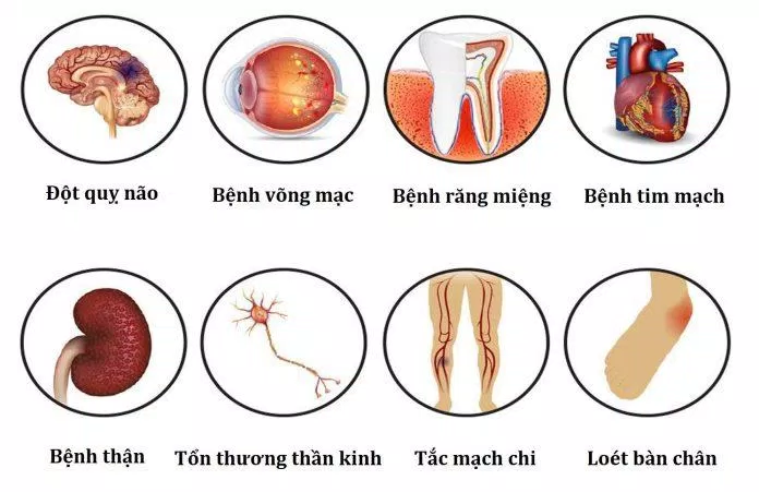 Biến chứng của tiểu đường