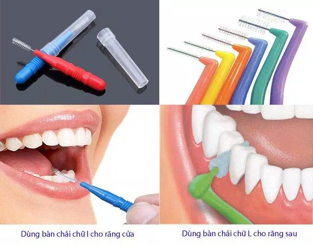chải răng đúng cách (Nguồn: Internet) 