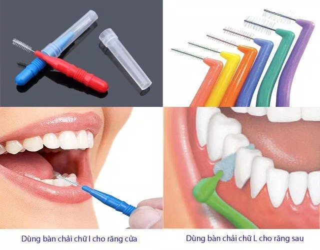 chải răng đúng cách (Nguồn: Internet) chải răng đúng cách (Nguồn: Internet)